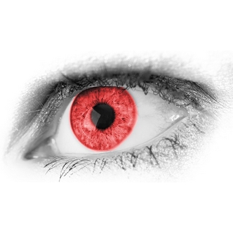 An angry red eye